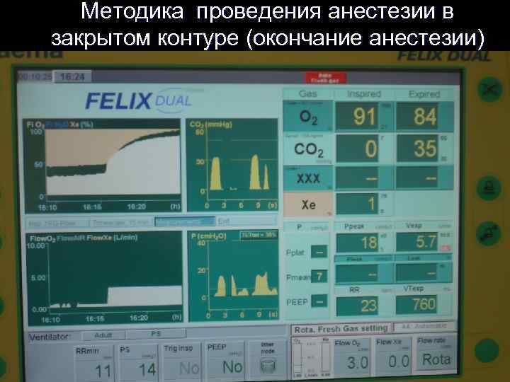 Методика проведения анестезии в закрытом контуре (окончание анестезии) 