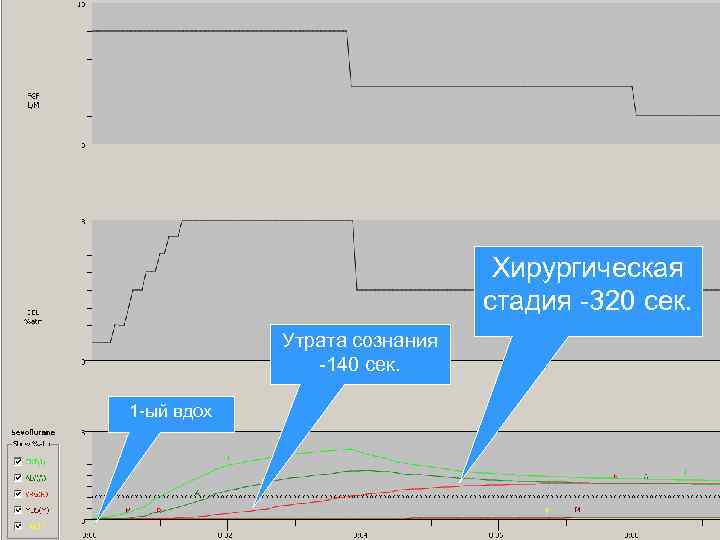 Хирургическая стадия -320 сек. Утрата сознания -140 сек. 1 -ый вдох 