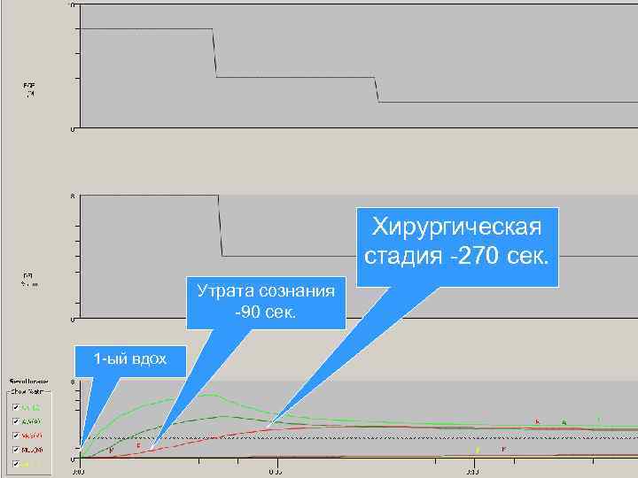 Хирургическая стадия -270 сек. Утрата сознания -90 сек. 1 -ый вдох 