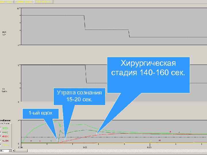 Хирургическая стадия 140 -160 сек. Утрата сознания 15 -20 сек. 1 -ый вдох 