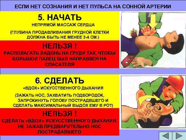 ЕСЛИ НЕТ СОЗНАНИЯ И НЕТ ПУЛЬСА НА СОННОЙ АРТЕРИИ 5. НАЧАТЬ НЕПРЯМОЙ МАССАЖ СЕРДЦА