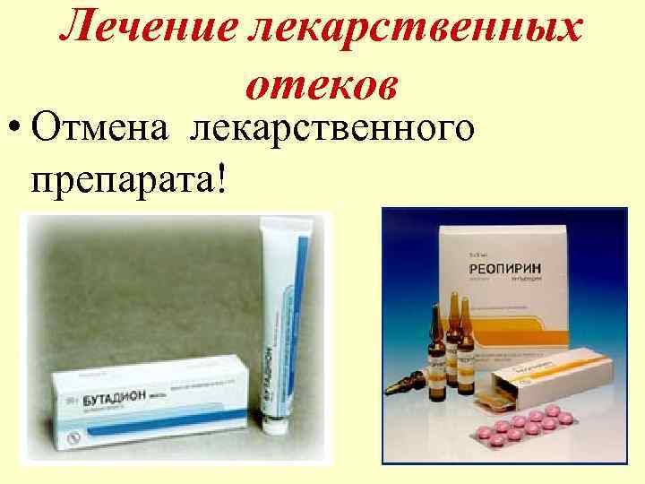 Лечение лекарственных отеков • Отмена лекарственного препарата! 