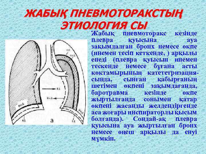 ЖАБЫҚ ПНЕВМОТОРАКСТЫҢ ЭТИОЛОГИЯ СЫ Жабық пневмоторакс кезінде плевра қуысына ауа зақымдалған бронх немесе өкпе