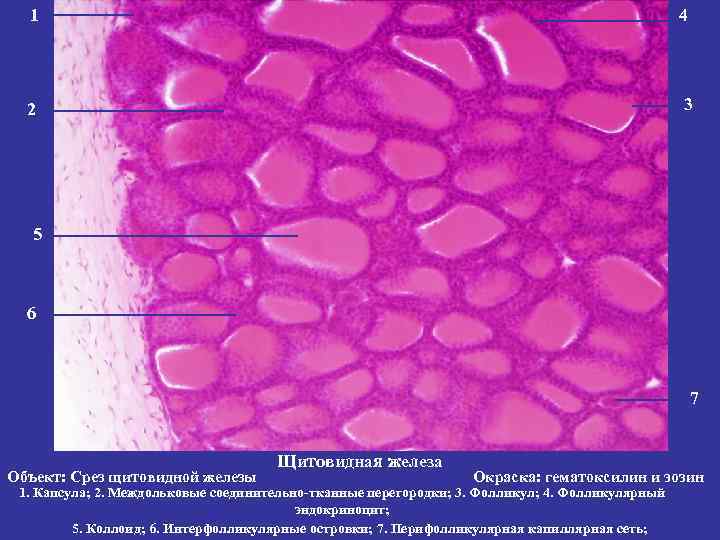 1 4 2 3 5 6 7 Объект: Срез щитовидной железы Щитовидная железа Окраска: