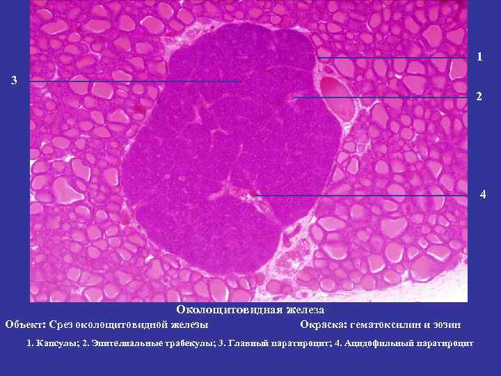 1 3 2 4 Околощитовидная железа Объект: Срез околощитовидной железы Окраска: гематоксилин и эозин