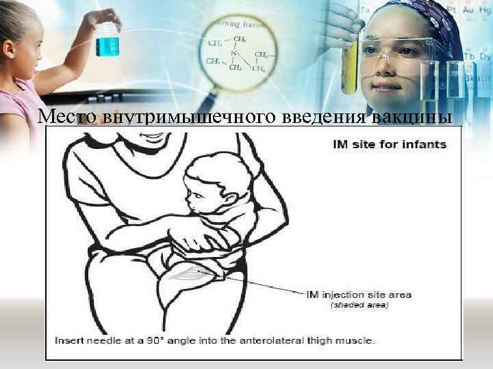 Место внутримышечного введения вакцины 