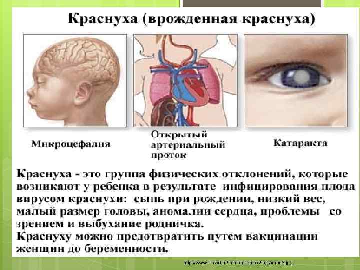 http: //www. f-med. ru/immunizations/img/imun 3. jpg 