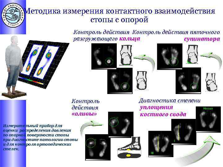 Методика измерения контактного взаимодействия стопы с опорой Контроль действия пяточного разгружающего кольца супинатора Контроль