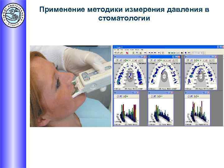 Применение методики измерения давления в стоматологии 