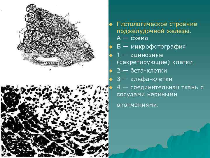 u u u Гистологическое строение поджелудочной железы. А — схема Б — микрофотография 1