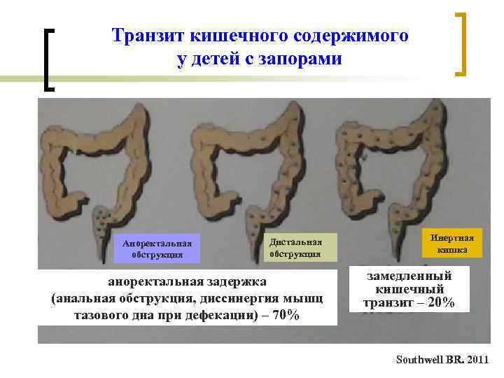 Транзит кишечного содержимого у детей с запорами Аноректальная обструкция Дистальная обструкция аноректальная задержка (анальная