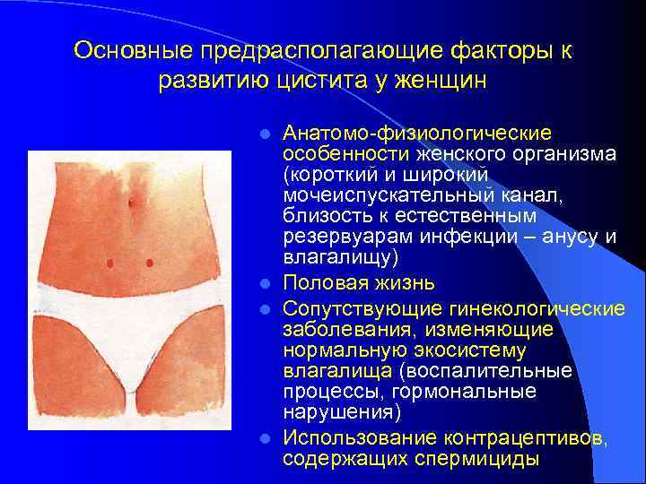 Основные предрасполагающие факторы к развитию цистита у женщин Анатомо-физиологические особенности женского организма (короткий и