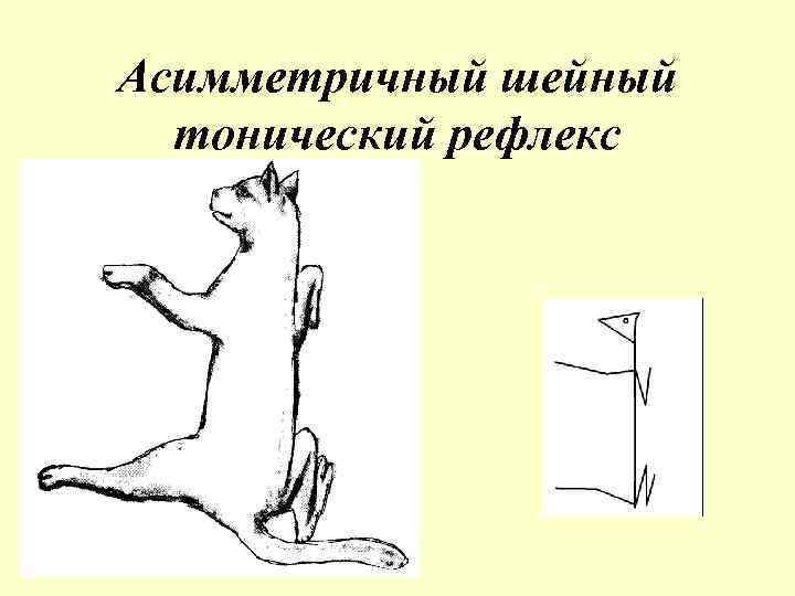 Асимметричный шейный тонический рефлекс 