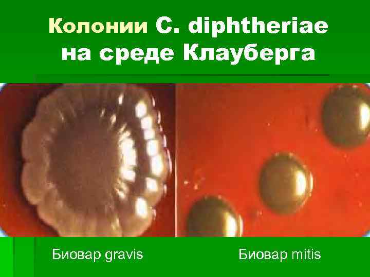 Колонии C. diphtheriae на среде Клауберга Биовар gravis Биовар mitis 