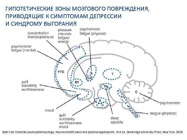 ГИПОТЕТИЧЕСКИЕ ЗОНЫ МОЗГОВОГО ПОВРЕЖДЕНИЯ, ПРИВОДЯЩИЕ К СИМПТОМАМ ДЕПРЕССИИ И СИНДРОМУ ВЫГОРАНИЯ Stahl S. M.