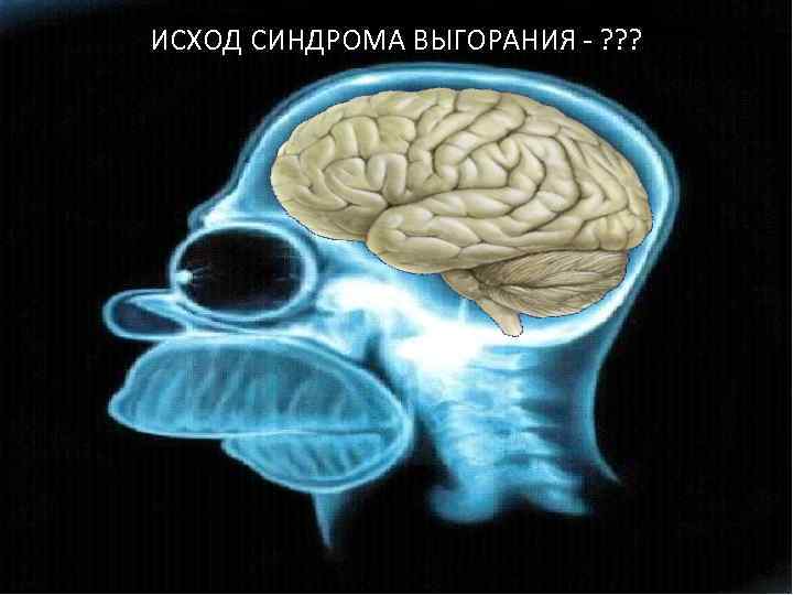 ИСХОД СИНДРОМА ВЫГОРАНИЯ - ? ? ? 