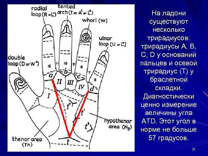 На ладони существуют несколько трирадиусов: трирадиусы A, B, C, D у оснований пальцев и