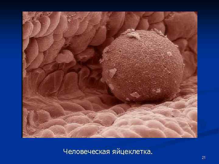 Человеческая яйцеклетка. 21 