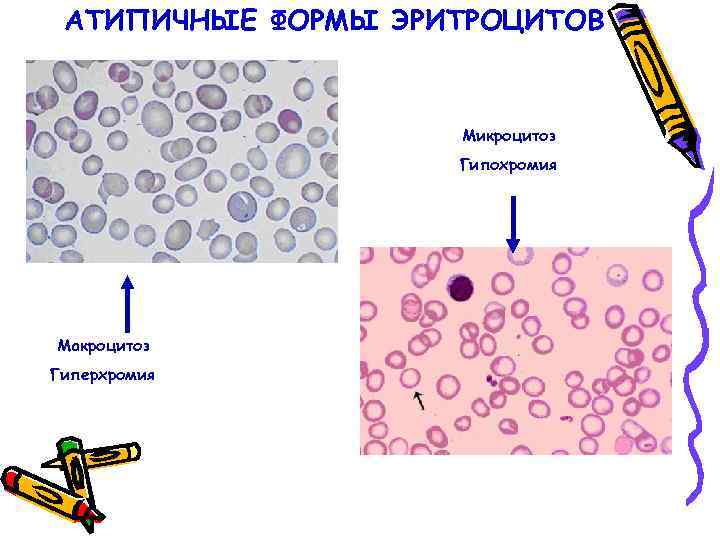 На рисунке схематично изображен эритроцитарный