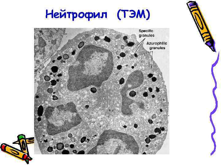 Нейтрофил (ТЭМ) 
