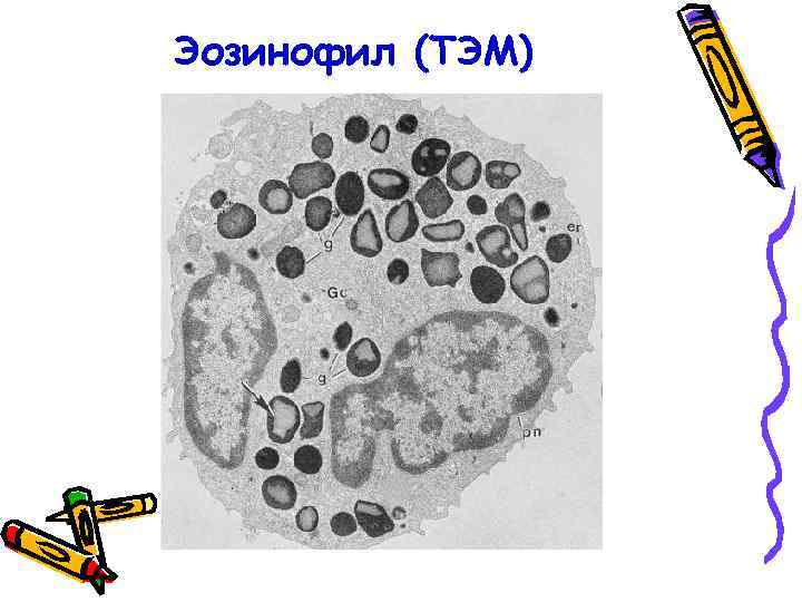 Эозинофил (ТЭМ) 