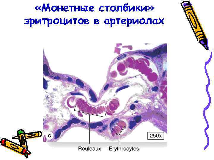  «Монетные столбики» эритроцитов в артериолах 