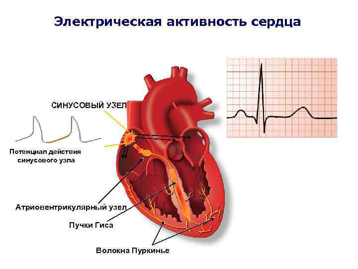 Синусовый узел сердца. Синусно предсердный узел расположен. Синусовый узел сердца волокна Пуркинье. Синусный узел сердца.