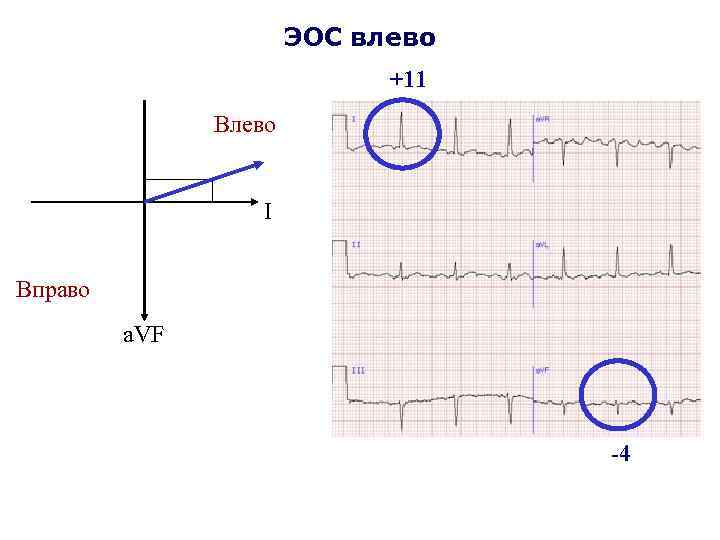 ЭОС влево +11 Влево I Вправо a. VF -4 