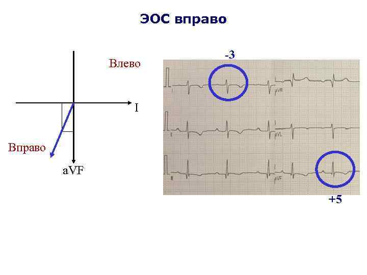 ЭОС вправо Влево -3 I Вправо a. VF +5 