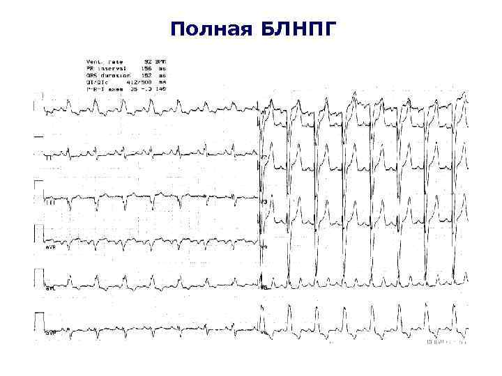 Полная БЛНПГ 