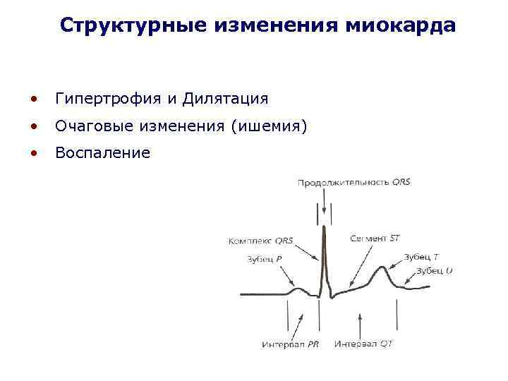 Структурные изменения миокарда • Гипертрофия и Дилятация • Очаговые изменения (ишемия) • Воспаление 