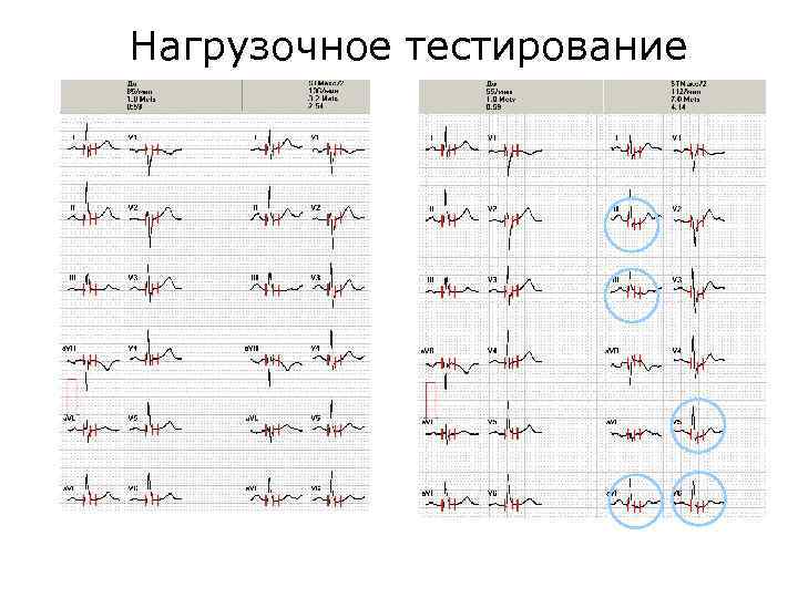 Нагрузочное тестирование 