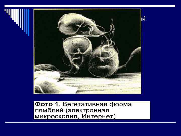 Вегетативная форма лямблий (электронная микроскопия) 