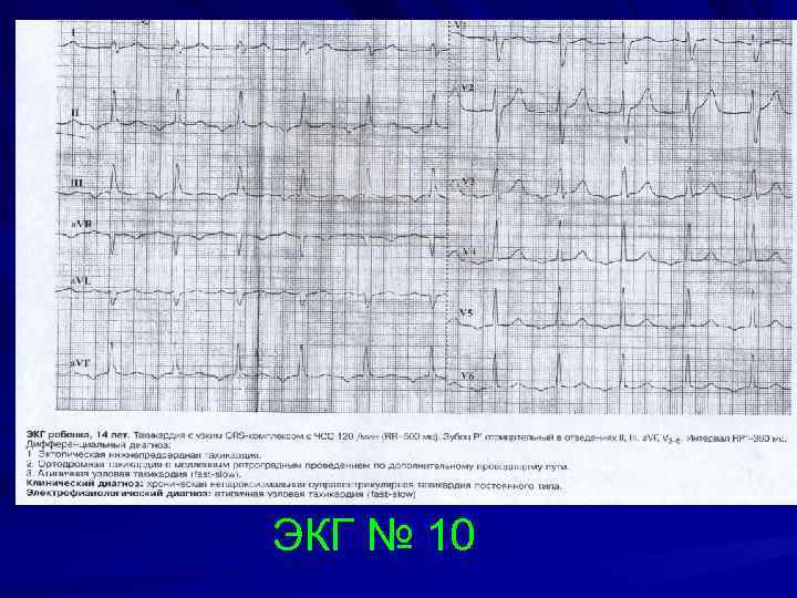 ЭКГ № 10 
