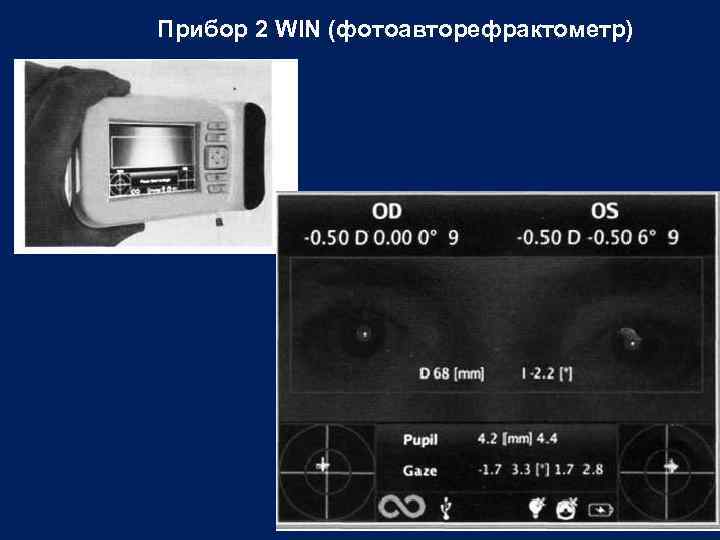 Прибор 2 WIN (фотоавторефрактометр) 