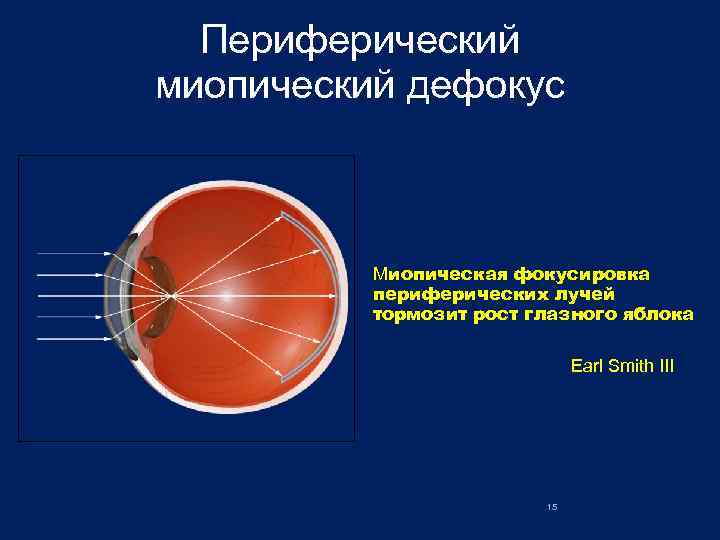 Использование периферического зрения при восприятии рентгеновского изображения тест