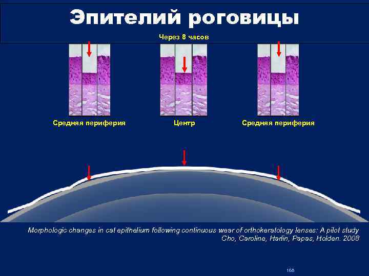 Эпителий роговицы Через 8 часов Cредняя периферия Центр Cредняя периферия Morphologic changes in cat
