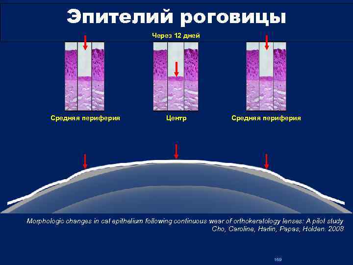 Эпителий роговицы Через 12 дней Cредняя периферия Центр Cредняя периферия Morphologic changes in cat