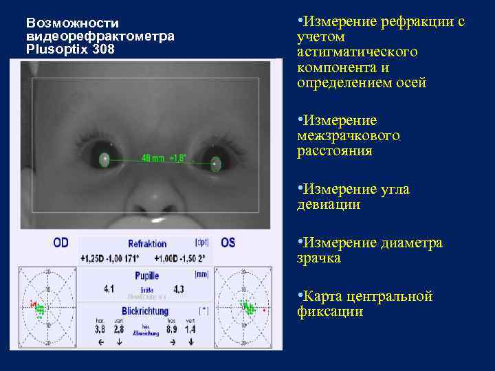 Возможности видеорефрактометра Plusoptix 308 • Измерение рефракции с учетом астигматического компонента и определением осей