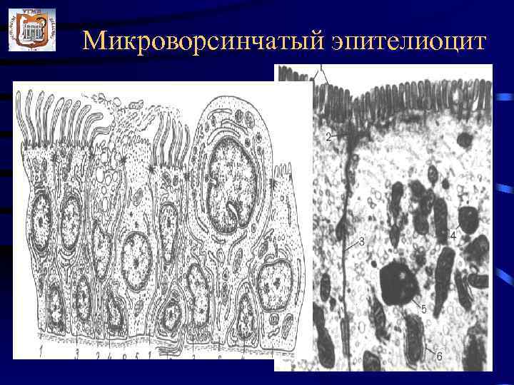 Микроворсинчатый эпителиоцит 