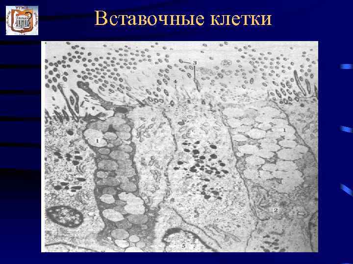 Вставочные клетки 