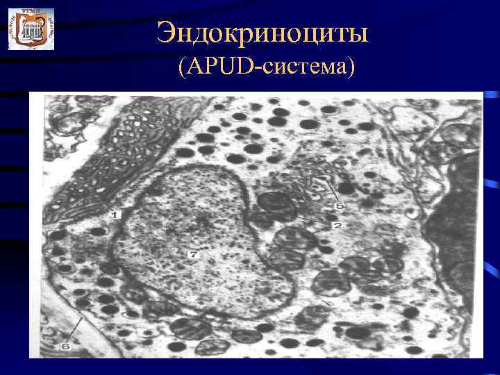 Эндокриноциты (APUD-система) 