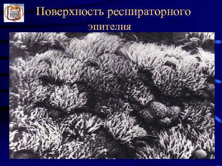 Поверхность респираторного эпителия 