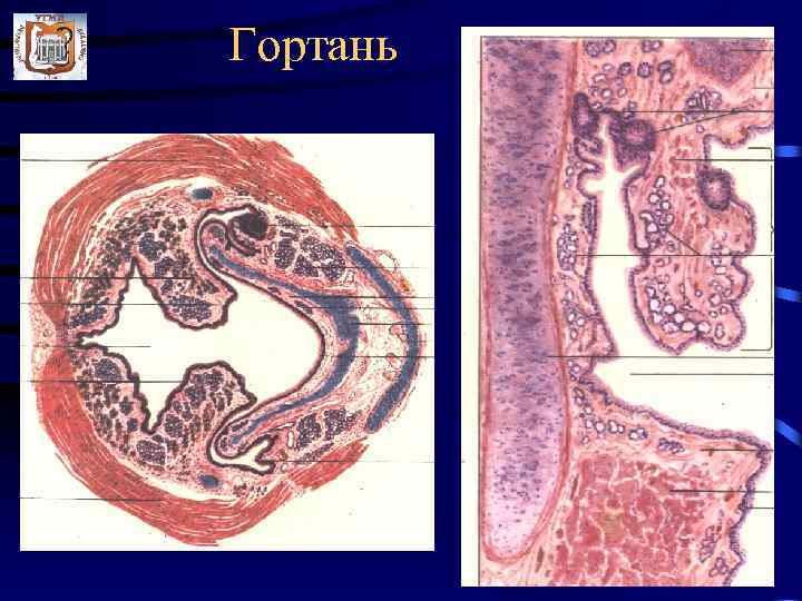 Трахея гистология. Строение стенки гортани гистология. Гортань гистология препарат. Надгортанник гистология препарат. Надгортанник строение гистология.