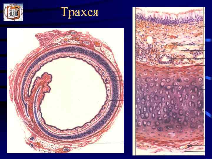 Трахея клетки. Препарат трахея поперечный срез. Поперечный срез трахеи гистология препарат. Препарат поперечный срез стенки трахеи. Трахея поперечный разрез гистология.