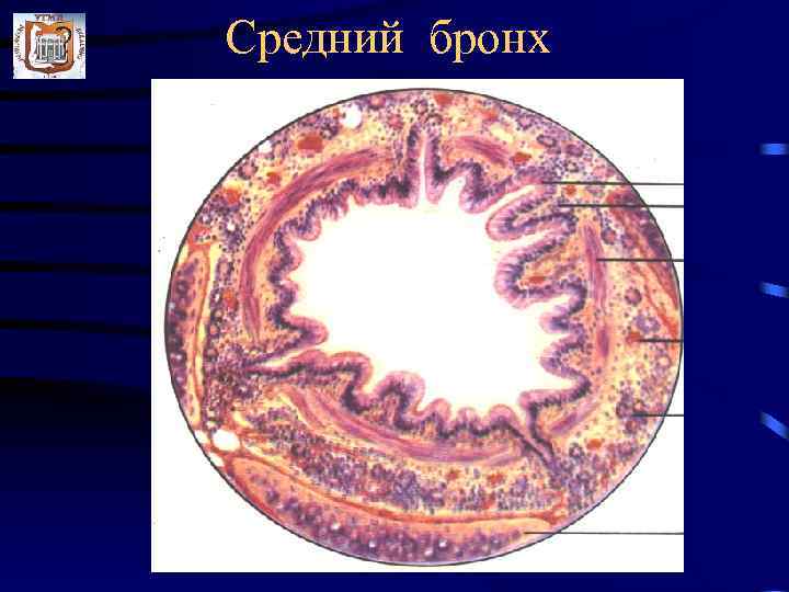 Средний бронх 