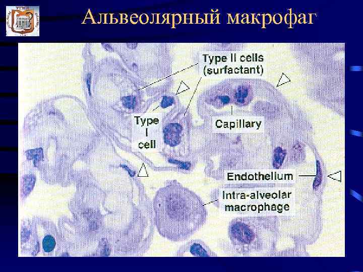 Альвеолярный макрофаг 