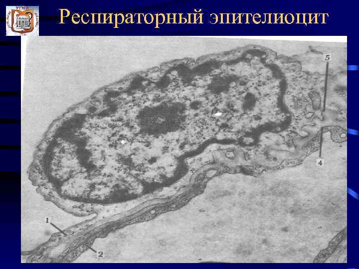 Респираторный эпителиоцит 