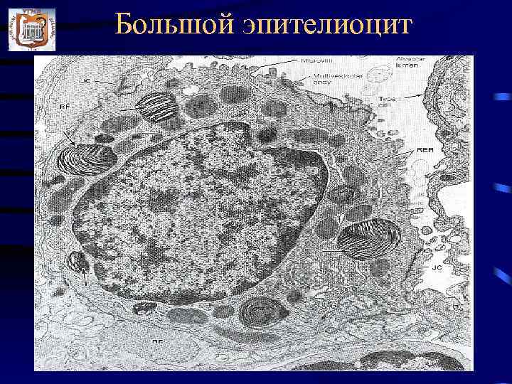 Большой эпителиоцит 