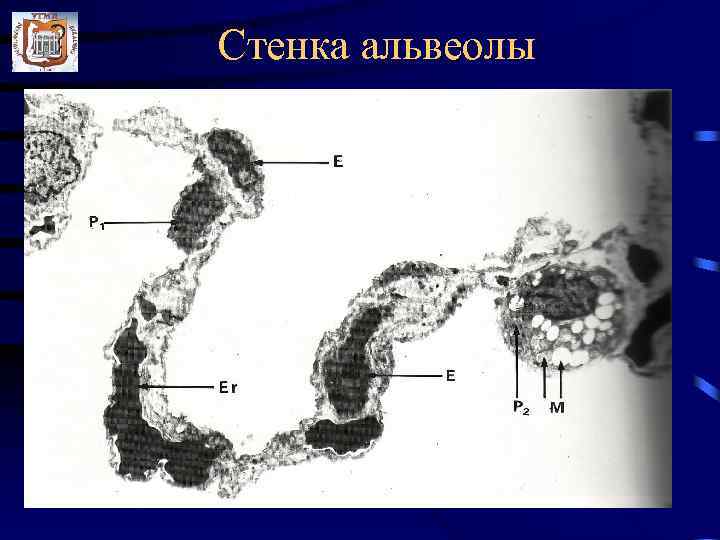 Стенка альвеолы 